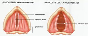 Воспаление носоглотки чем лечить в домашних условиях