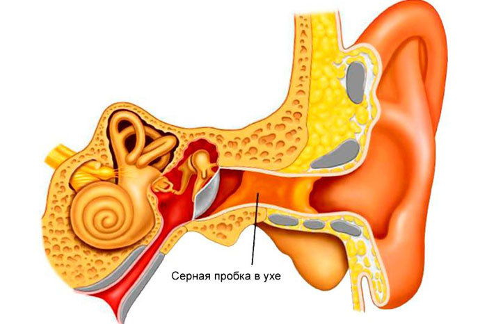 Почему возникает ощущение, что в ухе что-то двигается