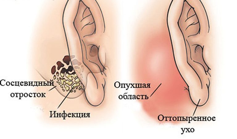 Причины болезненности ушной раковины
