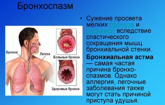 Лечение и профилактика воспаления бронхов