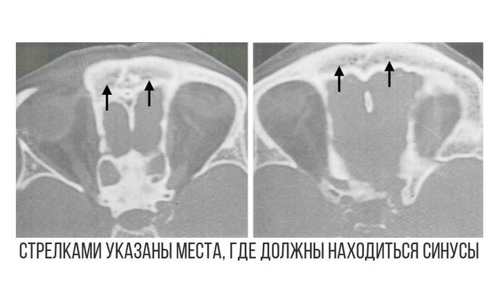 Особенности строения носовых пазух. Возможные заболевания