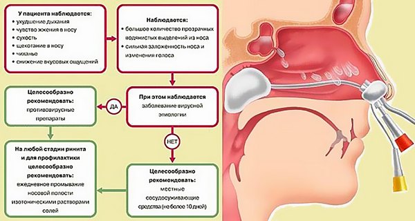 Виды ринита и лечение у детей