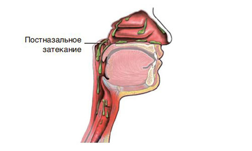 Когда слизь накапливается, это часто вызывает ночной и утренний кашель