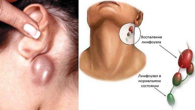 Избавляемся от боли в ухе быстро