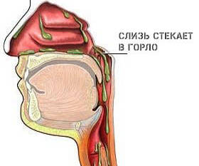 Почему не проходит кашель и что делать