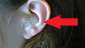 Как удалить серную пробку из уха самостоятельно в домашних условиях