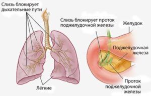 Околоносовые пазухи пневматизированы что это значит