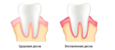 Комок в груди что это может быть