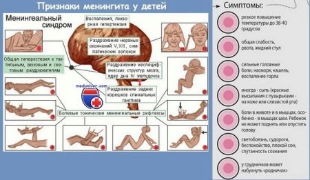 Стрептококковая ангина