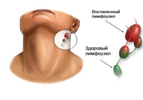 Боль за ухом справа причины, возможные заболевания, способы лечения, профилактика