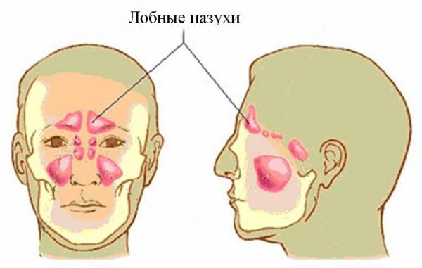 Проблемы с лобными пазухами