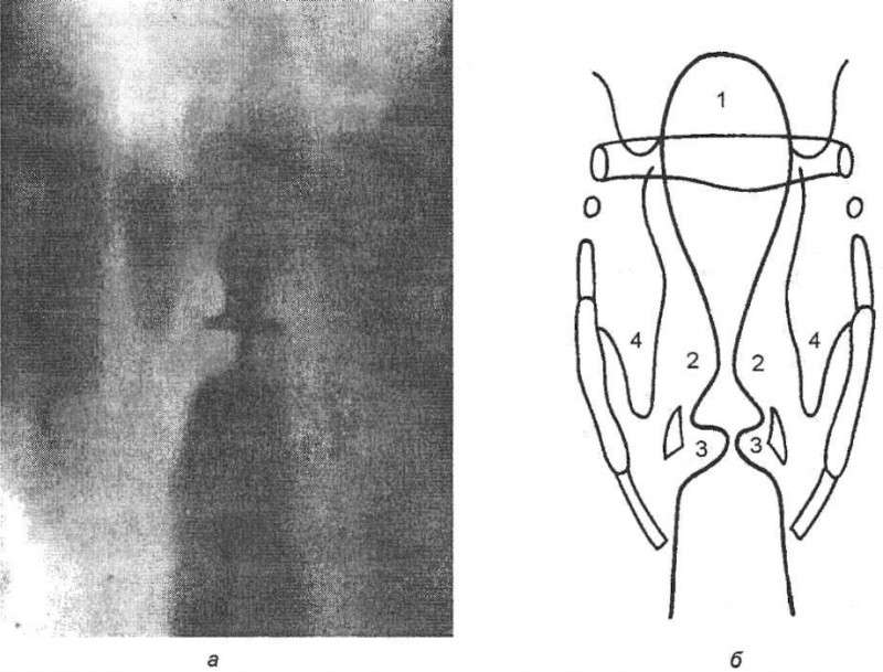 Что показывает УЗИ сканирование горла и гортани