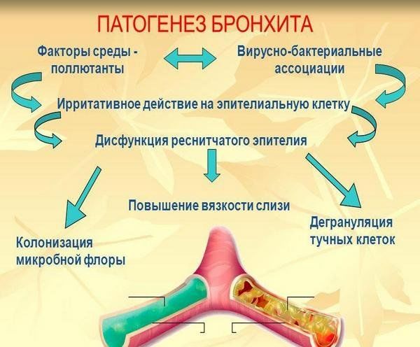 Лечение и профилактика воспаления бронхов