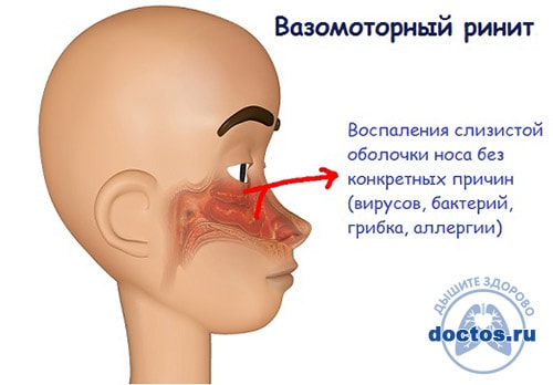 Почему не проходит кашель и что делать