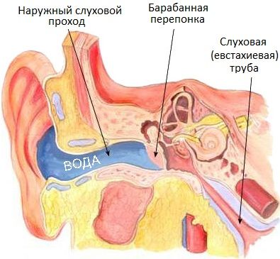 Что делать, если заложило уши возможные причины и варианты действий