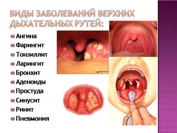 Аналоги Назол Адванс