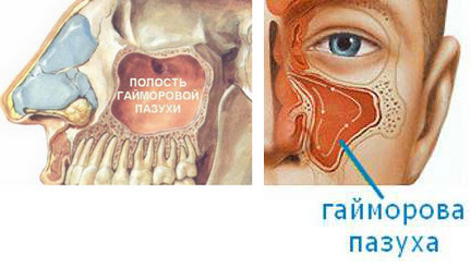 Особенности строения носовых пазух. Возможные заболевания