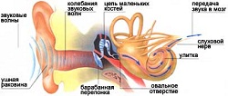 Признаки воспаления внутреннего уха