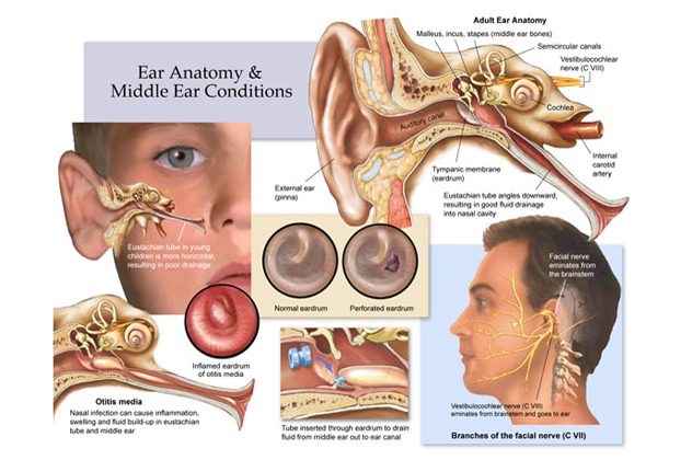 Причины, симптомы, стадии и лечение острого и хронического среднего отита