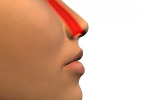 Кровяные корки в носу причины, клиническая картина, методы лечения