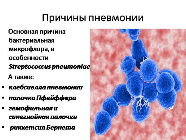 Антибиотики, эффективные для лечения пневмонии