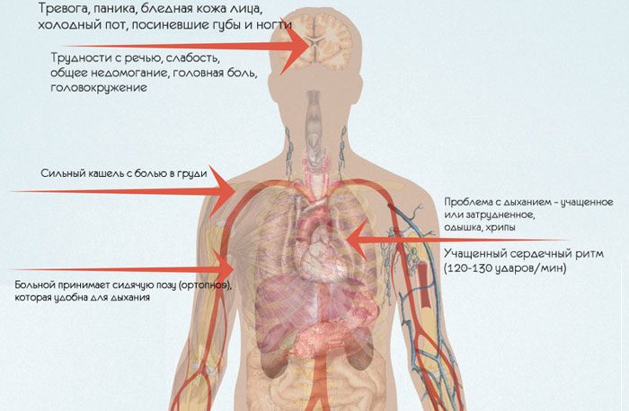 Отличия сухого кашля от влажного