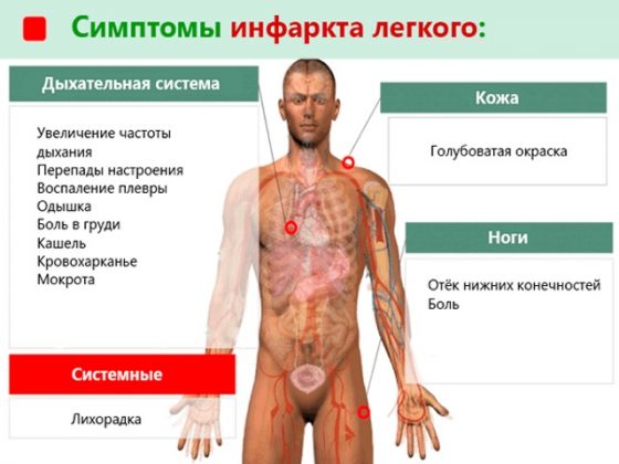 Мокрота курильщика и после отказа от курения. Сколько отходит и как избавиться