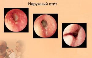 Боль за ухом справа причины, возможные заболевания, способы лечения, профилактика