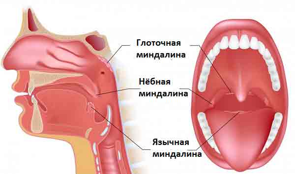 Увеличенные гланды причины, симптомы, лечение гипертрофии